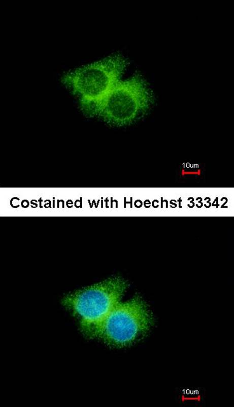 G protein-coupled receptor 62 antibody