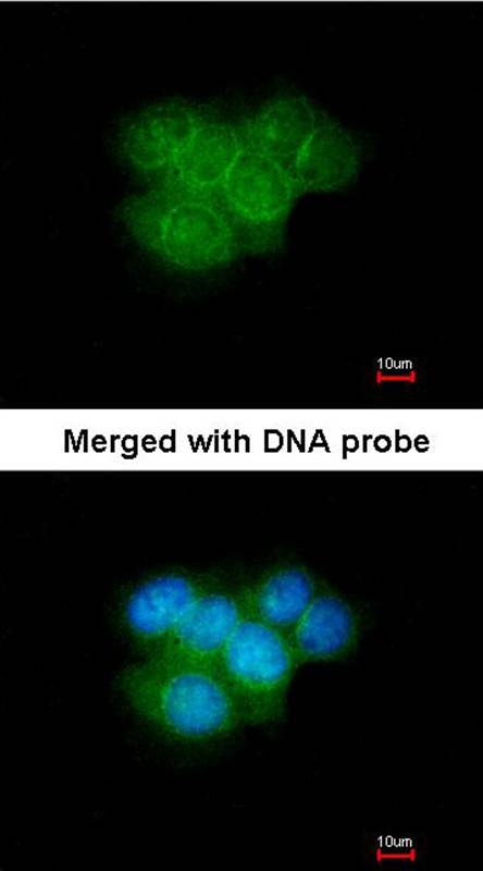 Calretinin antibody