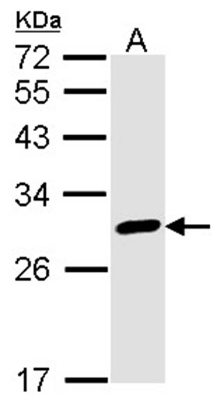 Calretinin antibody