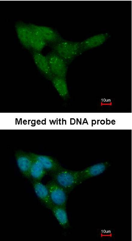 PRKD2 antibody