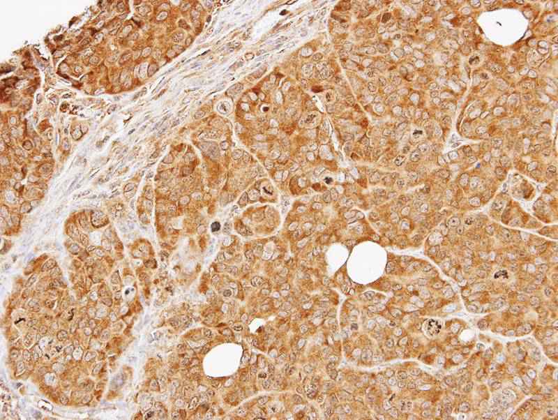 PRKD2 antibody