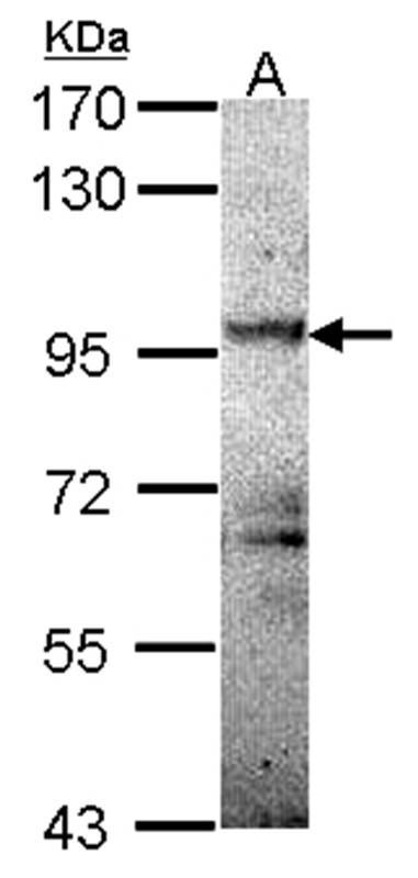 PRKD2 antibody