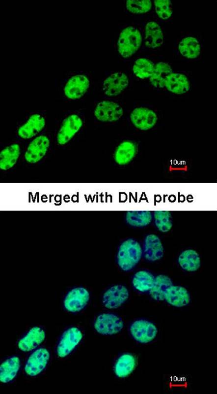 hnRNP F antibody