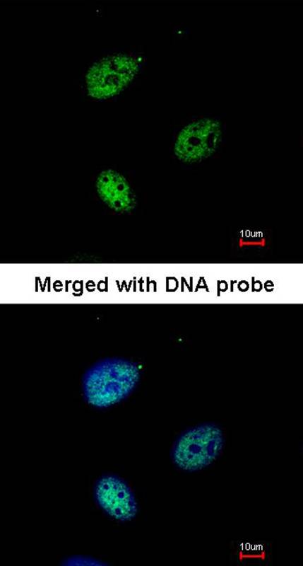 QIP1 antibody