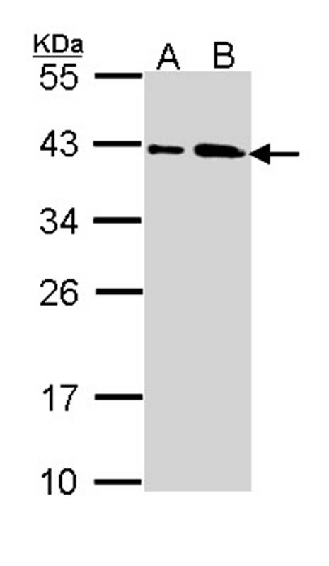 SAE1 antibody