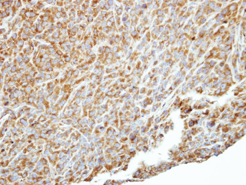 p150(PIK3R4) antibody