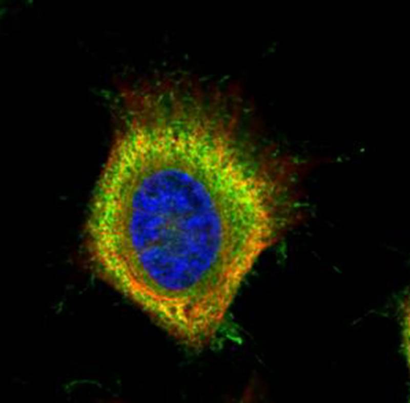 Fatty Acid Synthase antibody