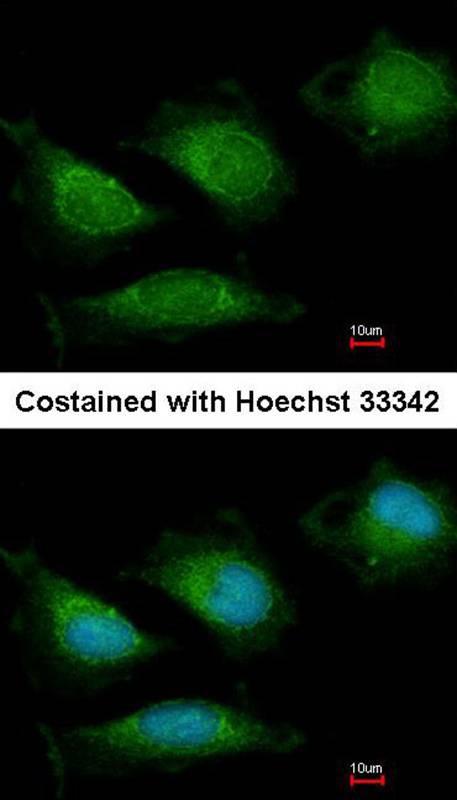 DNA Polymerase gamma antibody