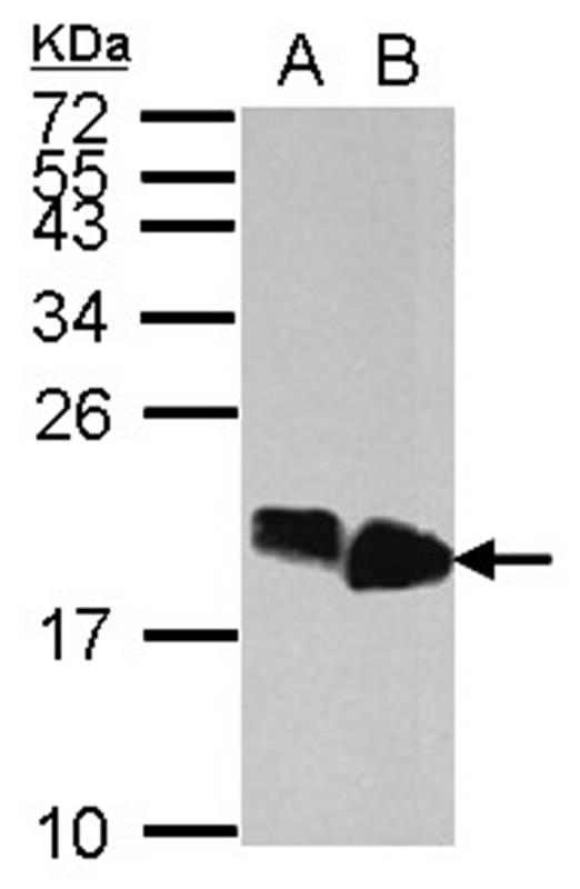 HMGA2 antibody