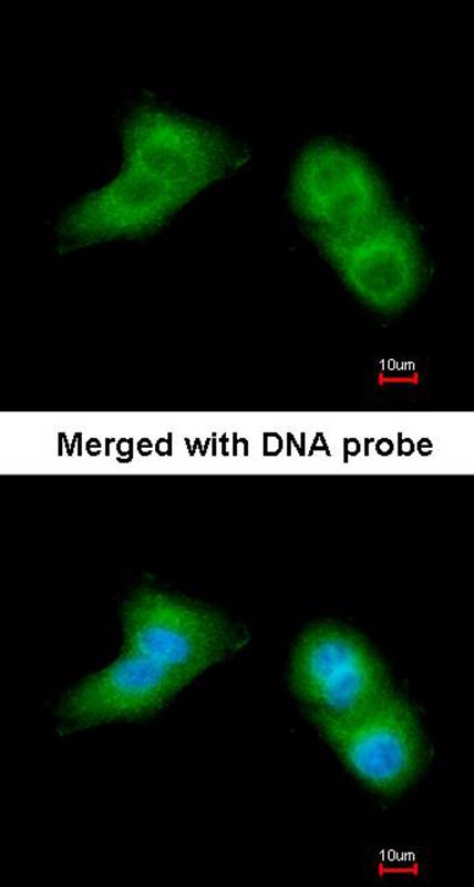 UBE2G2 antibody