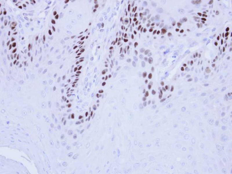 MCM3 antibody
