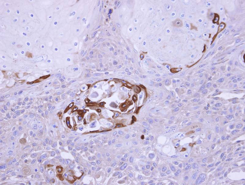 SOCS5 antibody