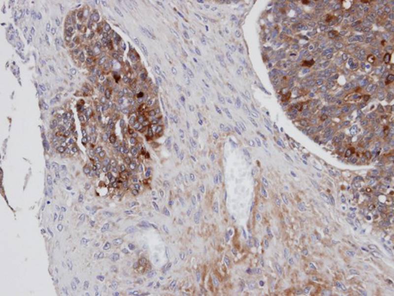 Mesothelin antibody