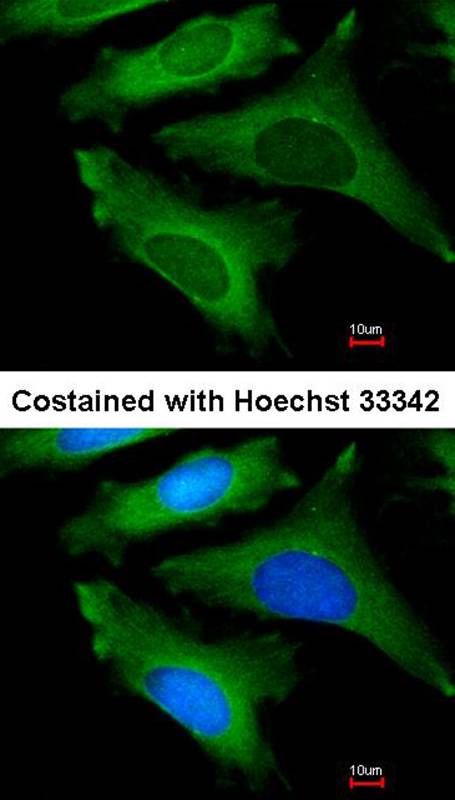 IL-1ra antibody