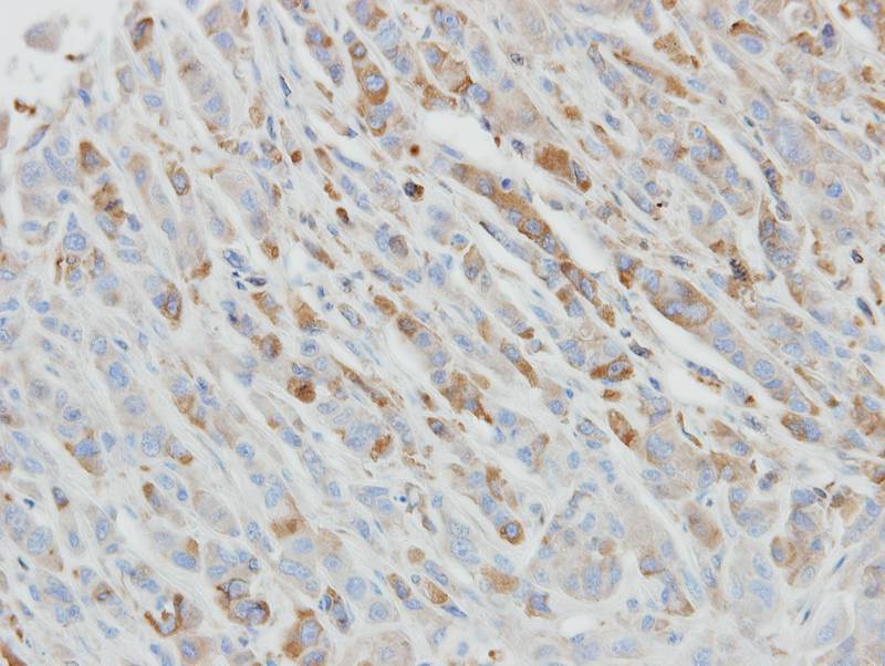 IL-1ra antibody