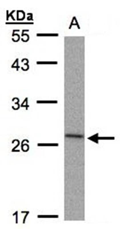 IL-1ra antibody