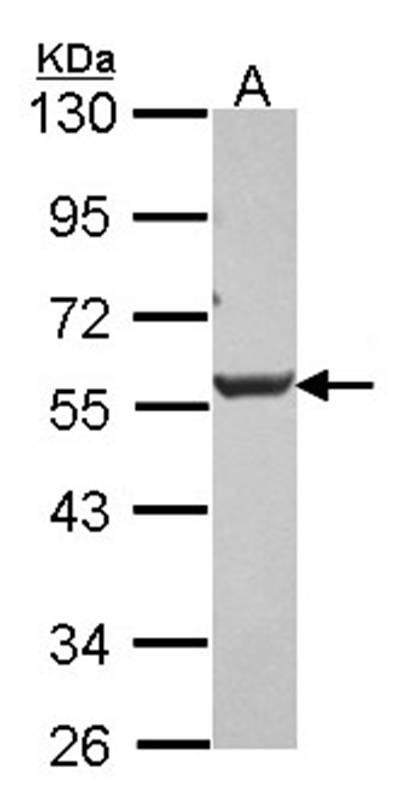 Dkk-3 antibody - SAB | Signalway Antibody