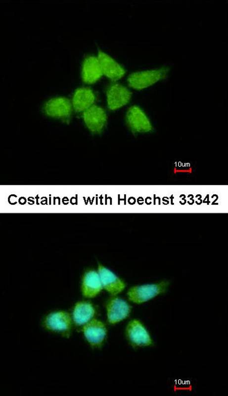 DUSP8 antibody
