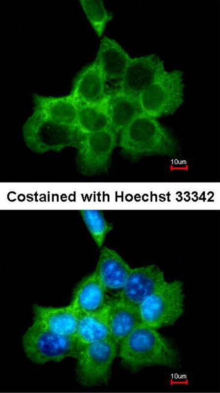 DOCK 180 antibody