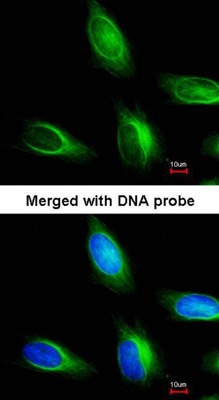 myotubularin related protein 4 antibody