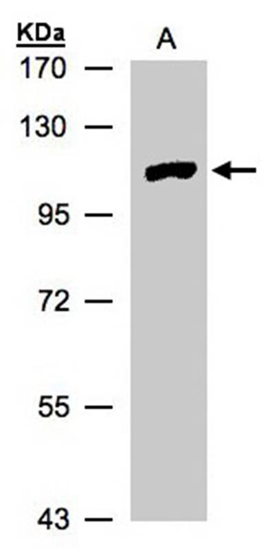 myotubularin related protein 4 antibody
