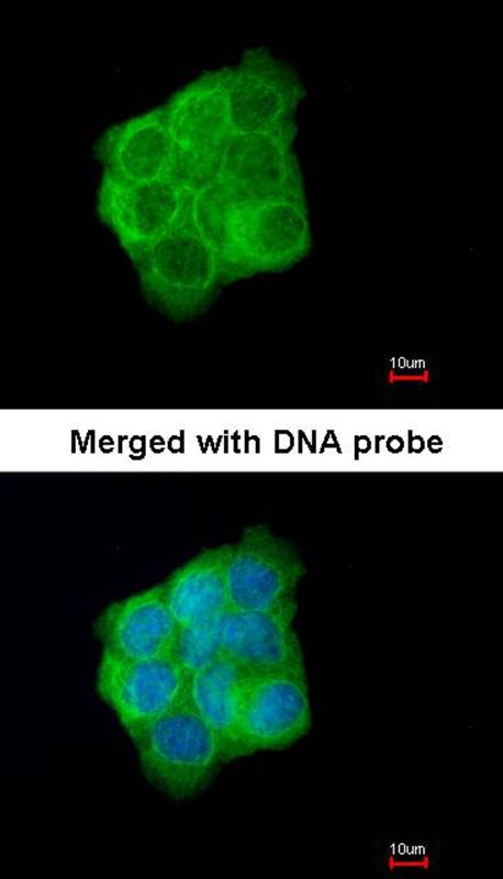 Cytokeratin 13 antibody