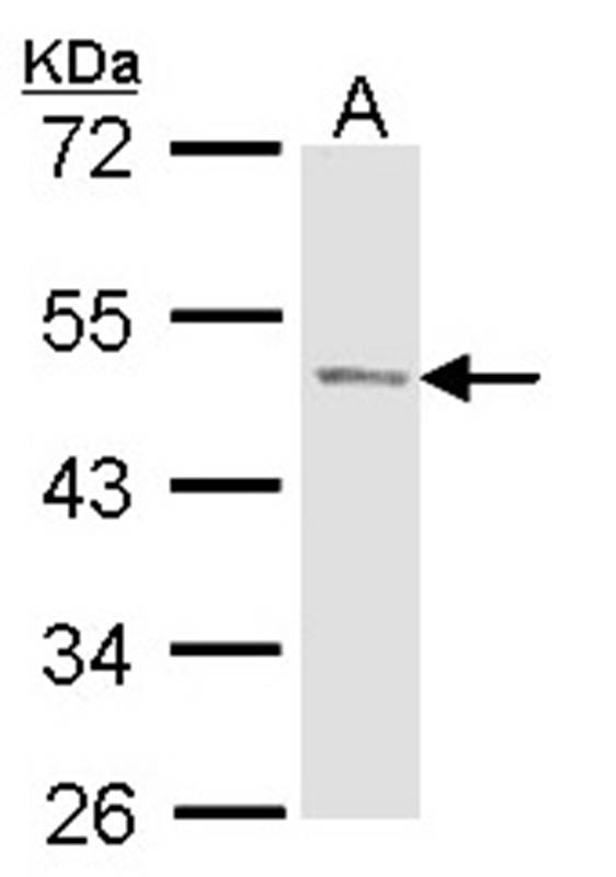 PAcP antibody