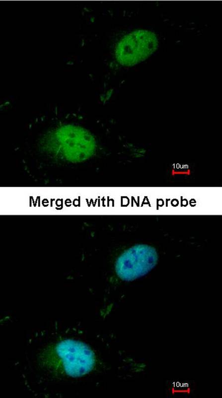HET/ SAF B antibody
