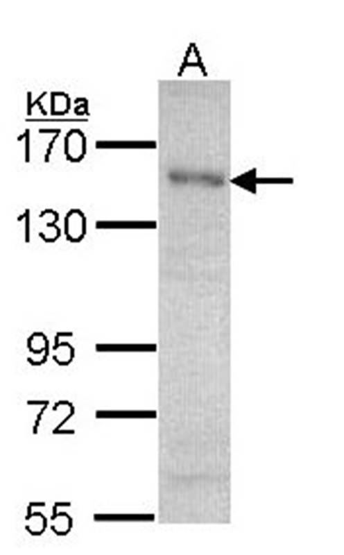 HET/ SAF B antibody