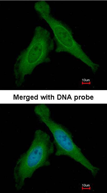 DDB1 antibody
