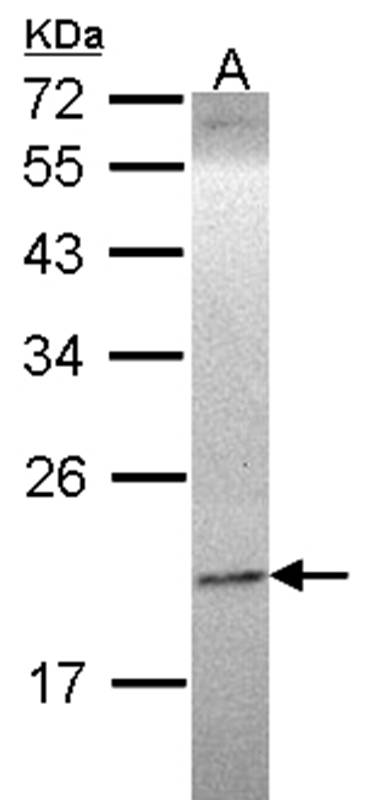 Ephrin A1 antibody