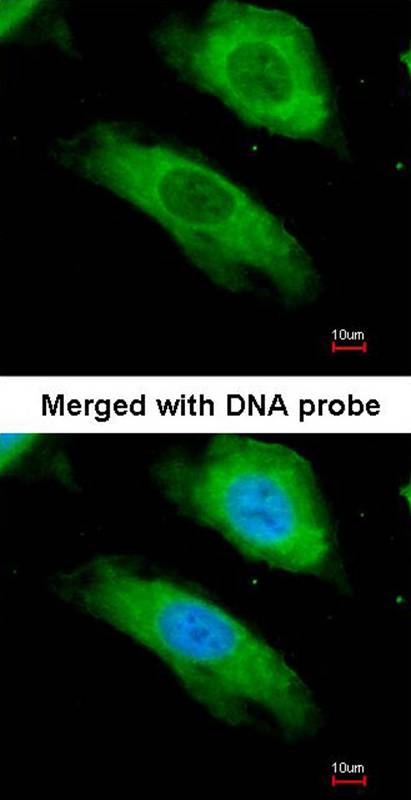 NQO1 antibody