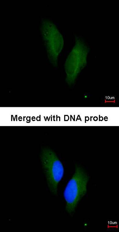 Protein S antibody