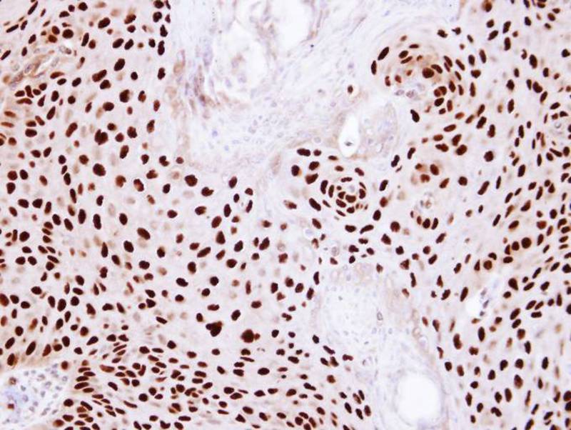 Ku80(XRCC5) antibody