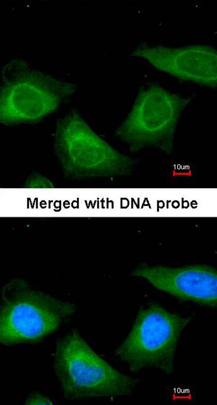 TBG antibody