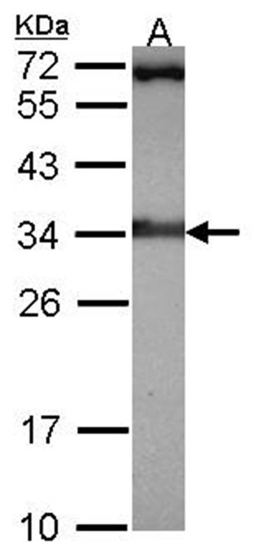Rad1 antibody