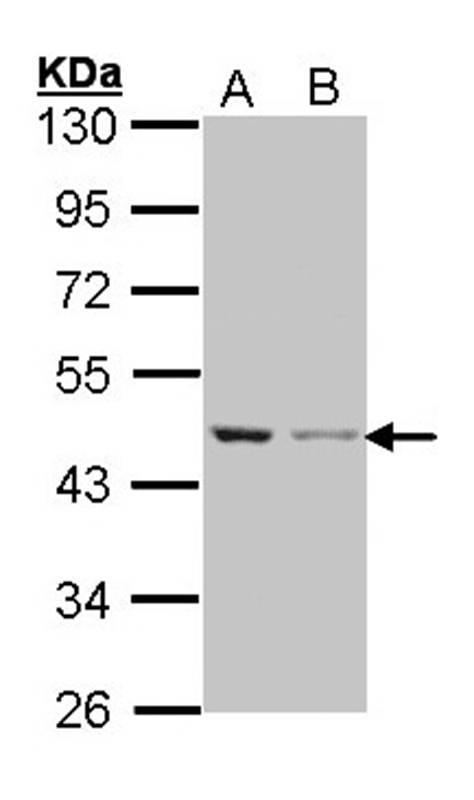 Beta Actin antibody