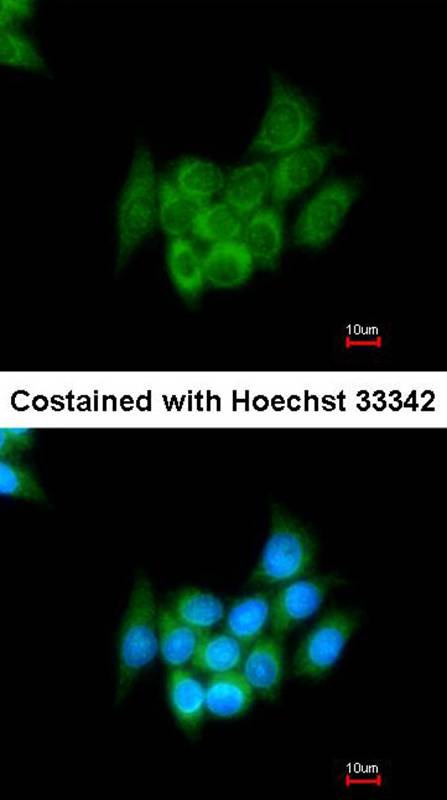 Angiotensin antibody