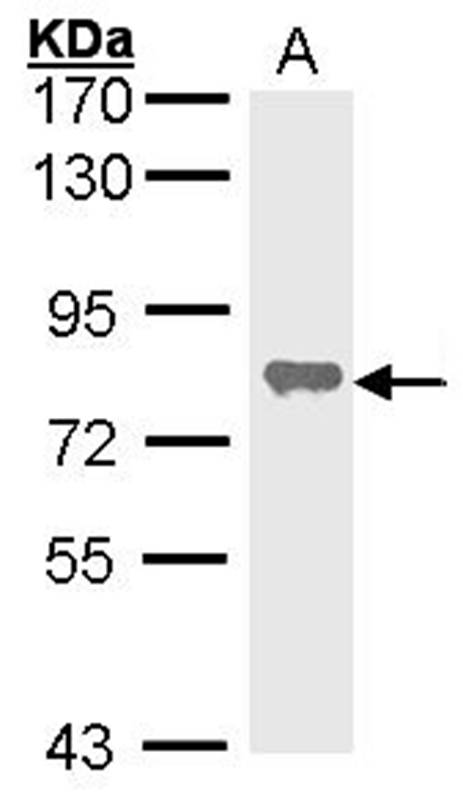 alkaline phosphatase(liver/bone/kidney) antibody