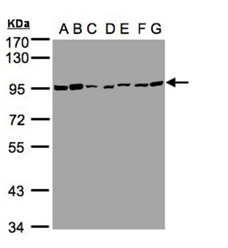 CD66e antibody