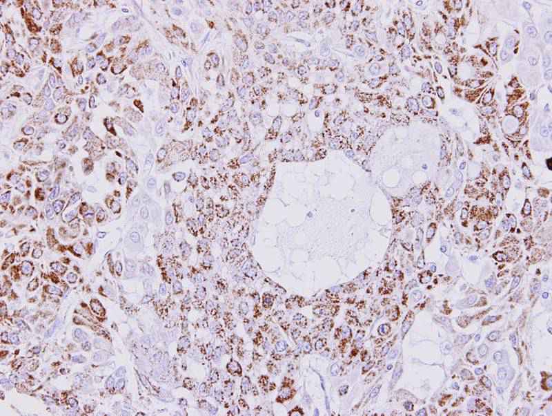 Creatine kinase(mitochondrial 1B) antibody