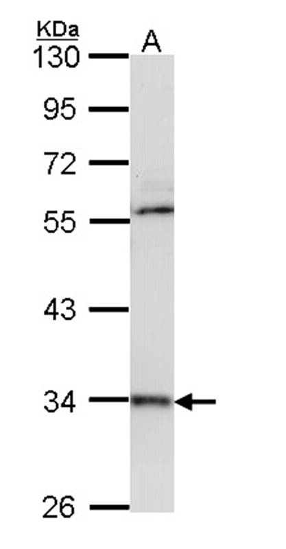 cathepsin D antibody