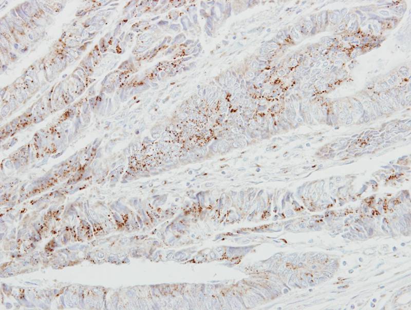 GALNT2 antibody