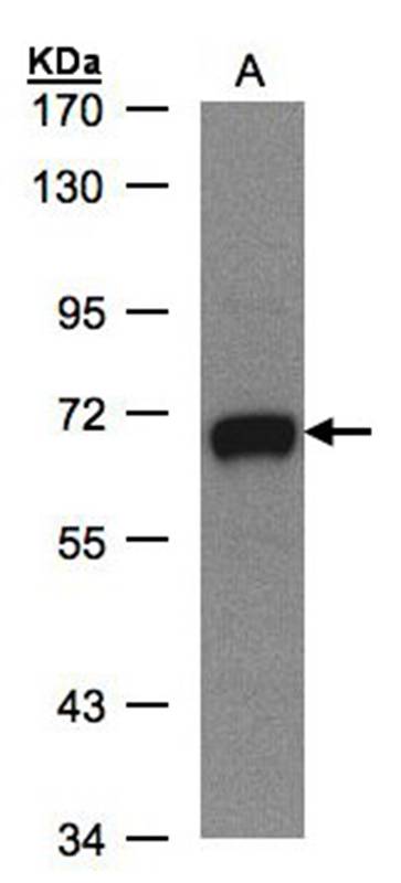 GALNT2 antibody