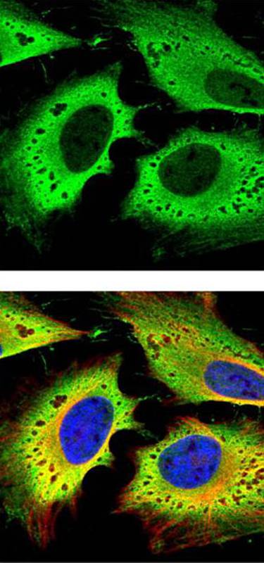 GAPDH antibody