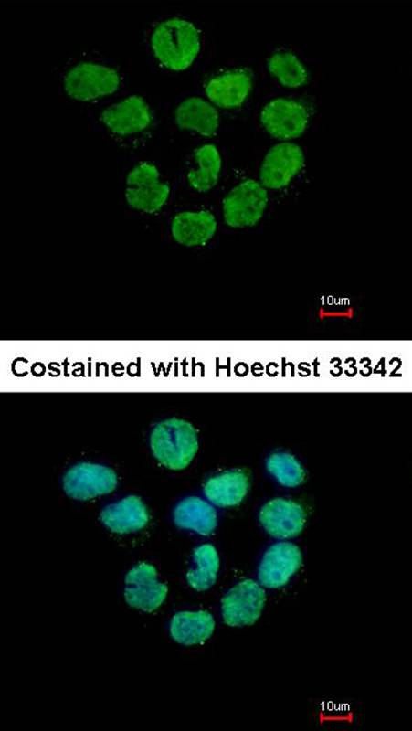 Histone H2A.Z/H2A.F/Z antibody