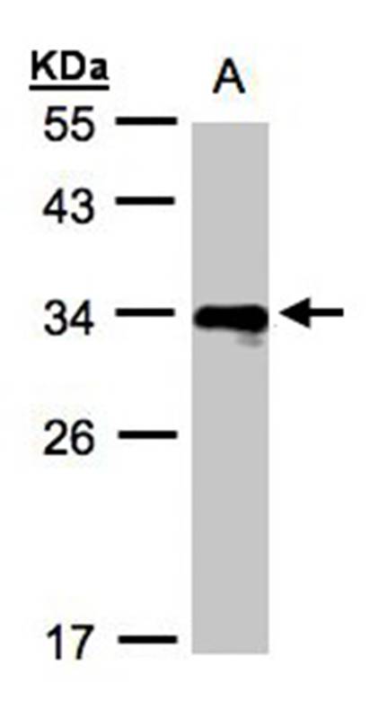 HLA DR beta antibody