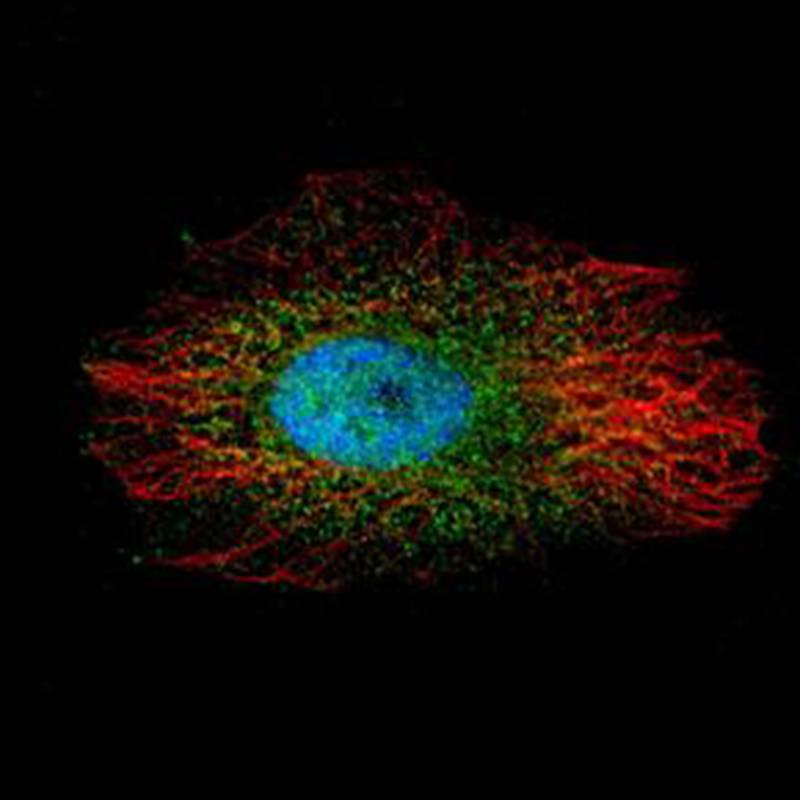 LIM kinase 2 antibody