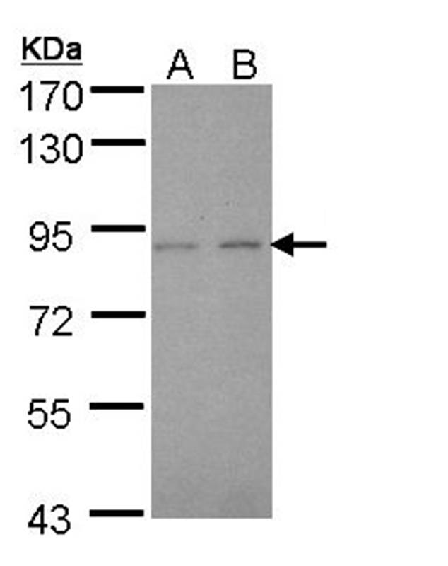LIM kinase 2 antibody
