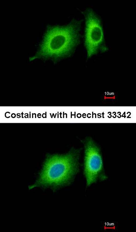 p-Tau antibody